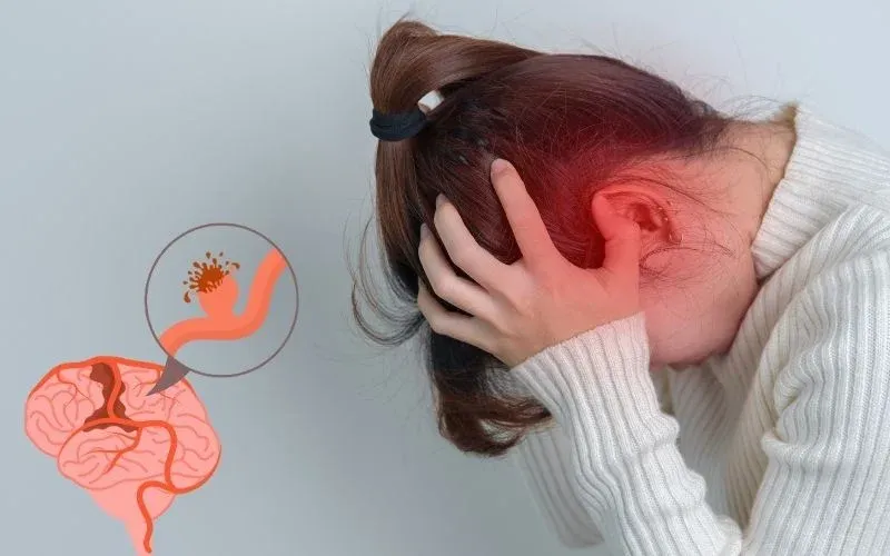 خونریزی مغزی