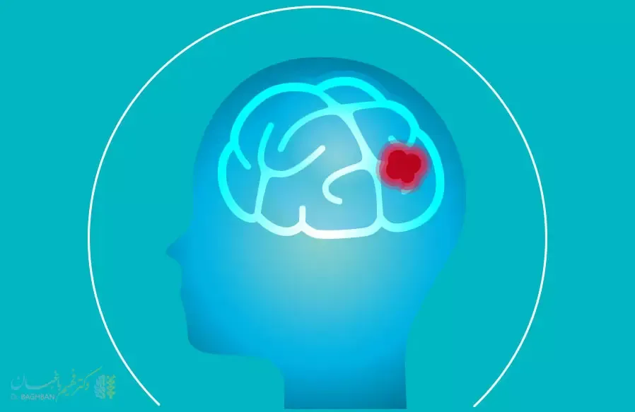 تومور سی پی انگل