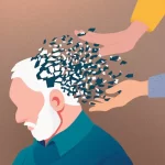 بیماری آلزایمر