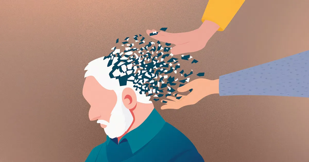 بیماری آلزایمر