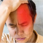 سردرد خوشه ای