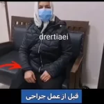 ویدئو: رضایت بیمار خانم از جراحی پارکینسون توسط دکتر ارتیاعی