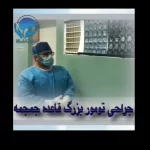 Large skull base tumor surgery video